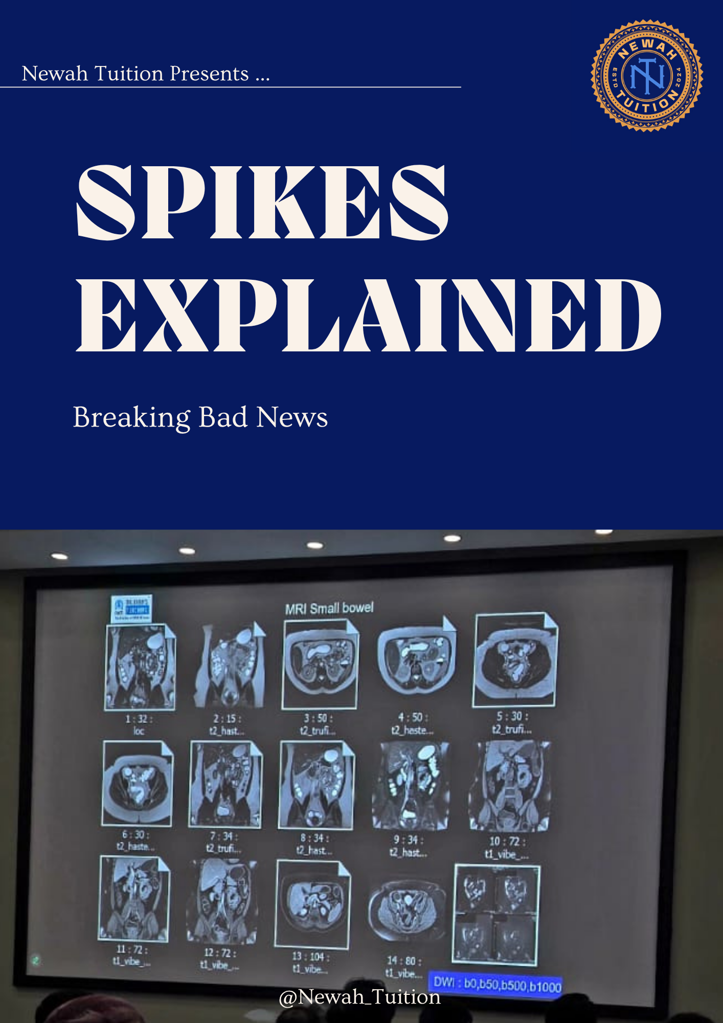 SPIKES Explained: Breaking Bad News